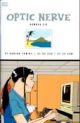OPTIC NERVE US06